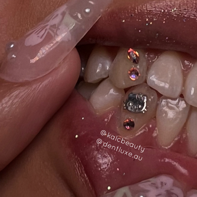 18k Gold Tooth Gem HELLO KITTY