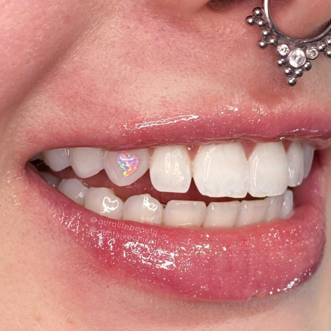 Heart Opal Tooth Gems