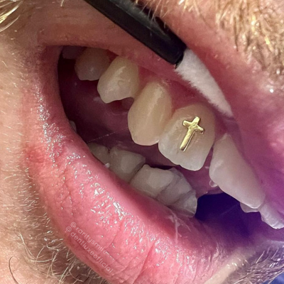 18k Gold Tooth Gem CROSS