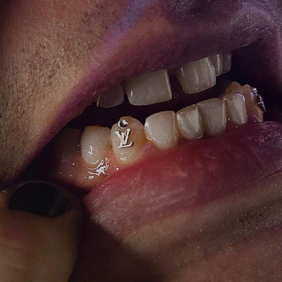 18k Gold LV Tooth Gem