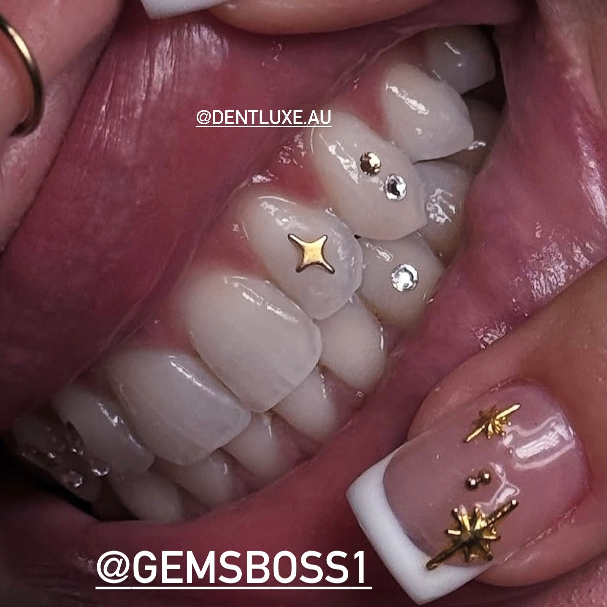 18k Gold Tooth Gem TWINKLE STAR sparkle 4 point star 