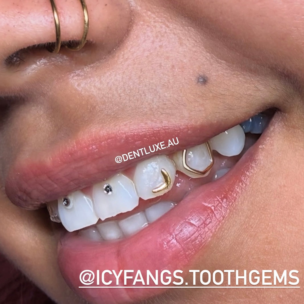 18k Gold Tooth Gem CORNER L SHAPE