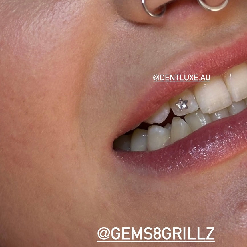 Micro CZ Stars Swarovski cubic zirconia diamonds tooth gems