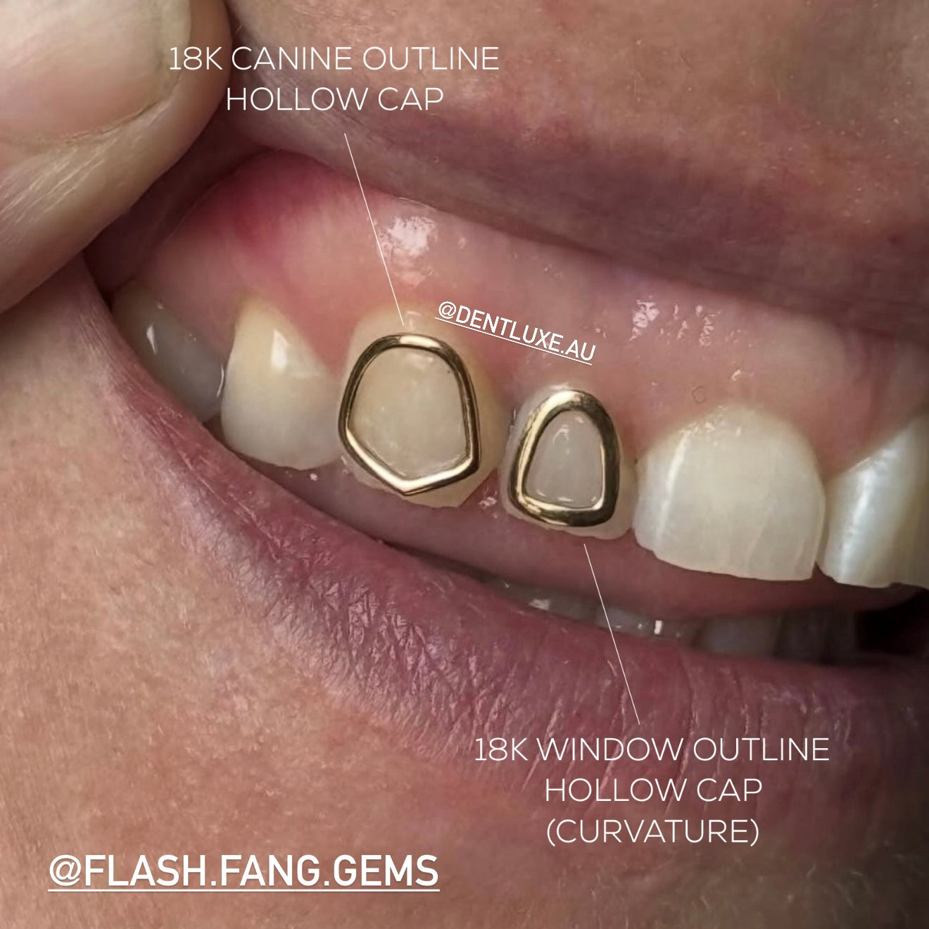 18k Gold Tooth Gem CANINE HOLLOW CAP