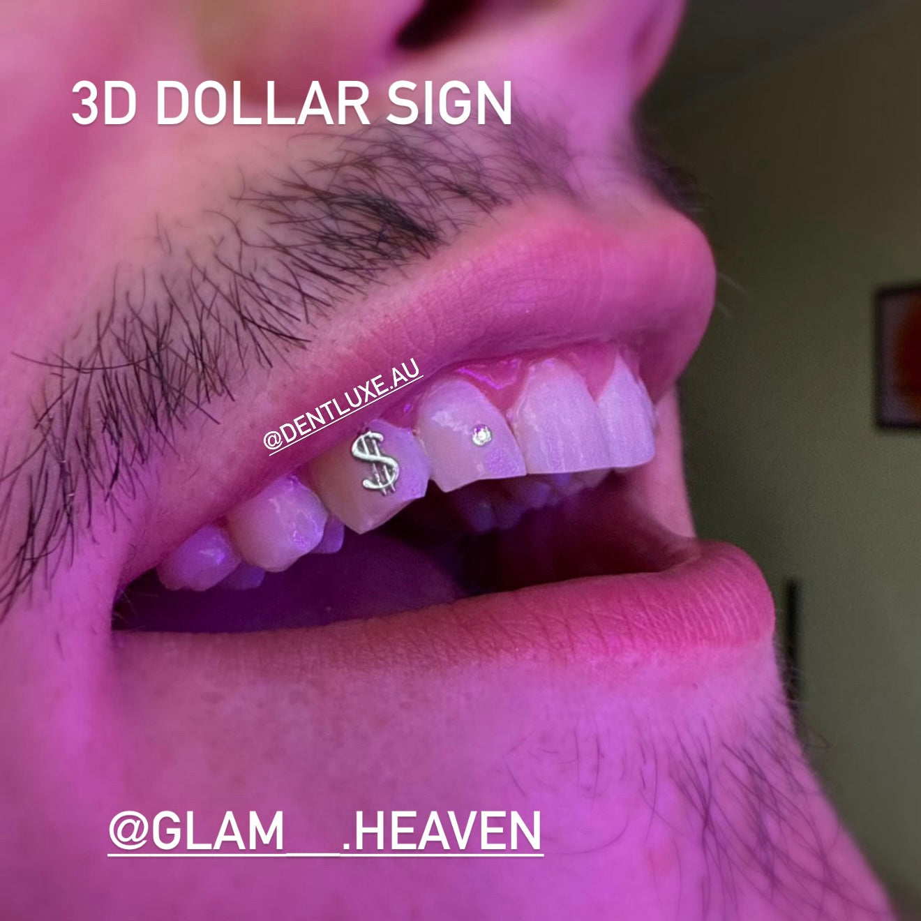 18k Gold Tooth Gem DOLLAR SIGN