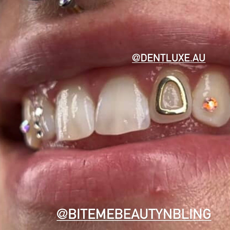 18k Gold Tooth Gem WINDOW OUTLINE HOLLOW CAP (CURVATURE)