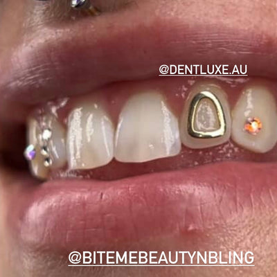 18k Gold Tooth Gem WINDOW OUTLINE HOLLOW CAP (CURVATURE)