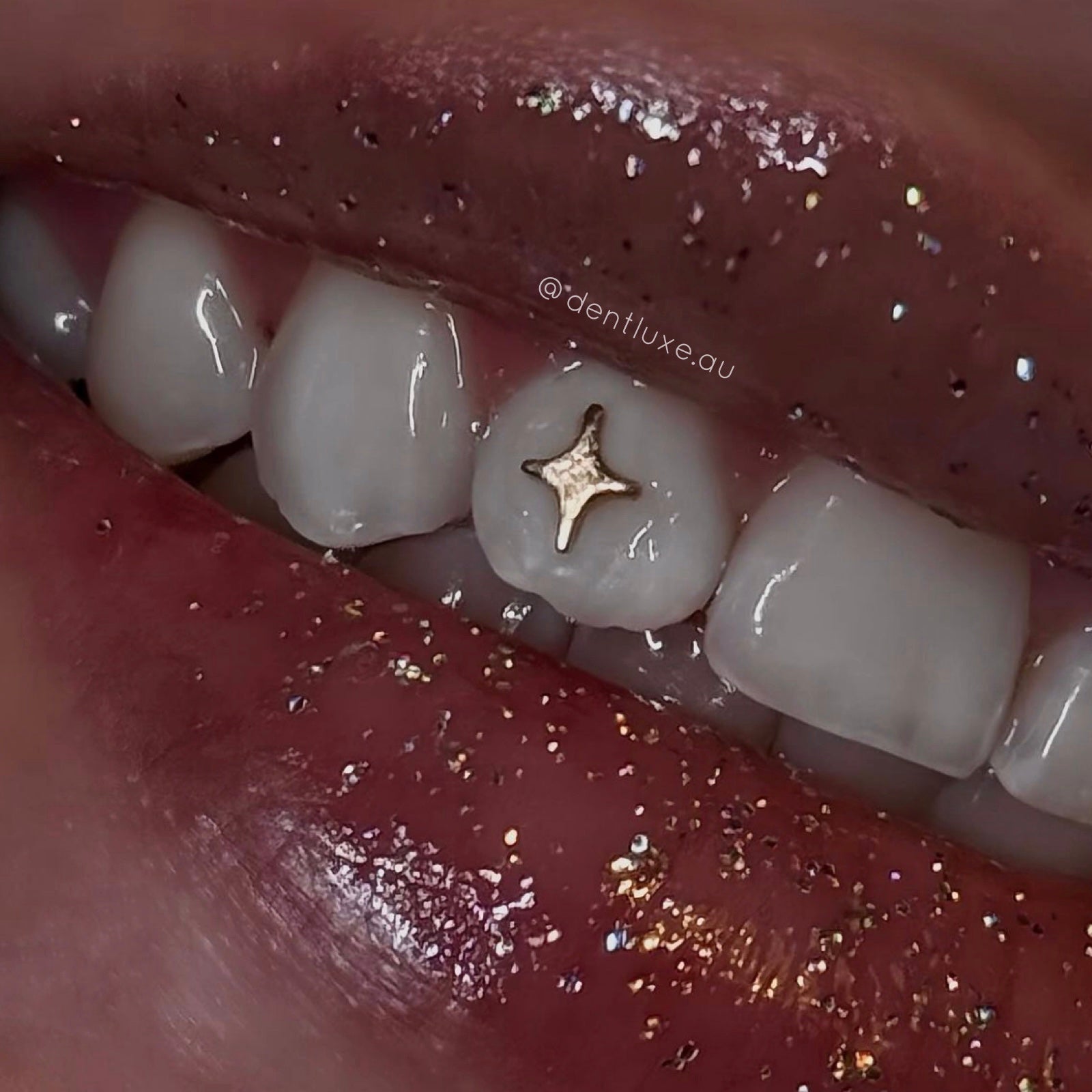 18k Gold Tooth Gem TWINKLE STAR - Dentluxe