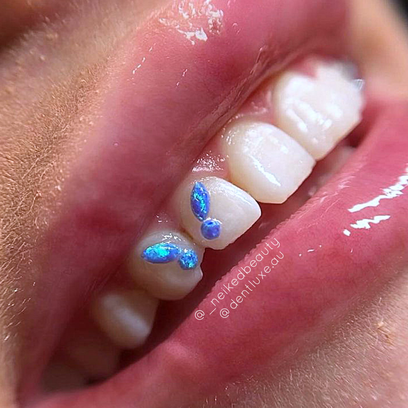 Butterfly Set Opal Tooth Gems