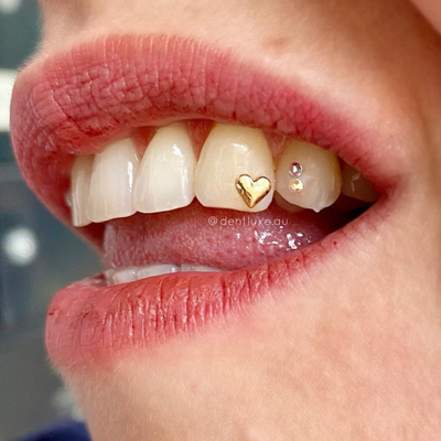 18k Gold Heart Tooth Gems