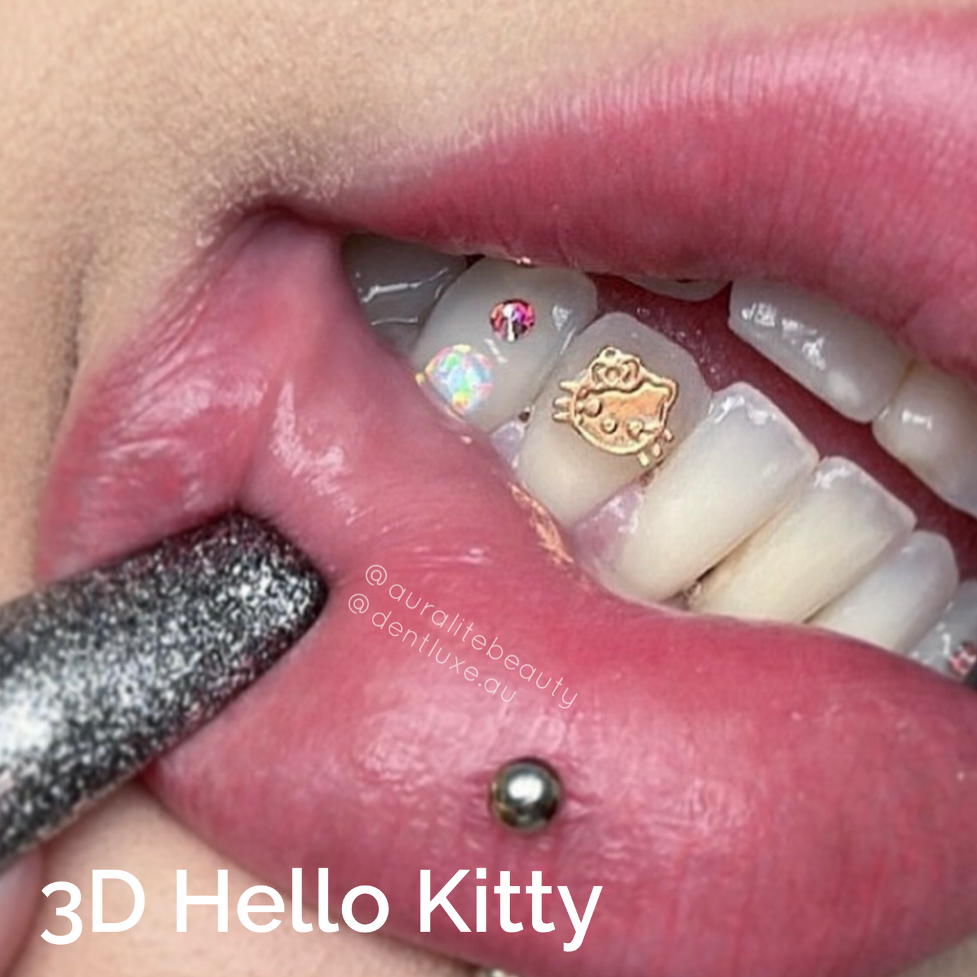 18k Gold Tooth Gem HELLO KITTY Dentluxe