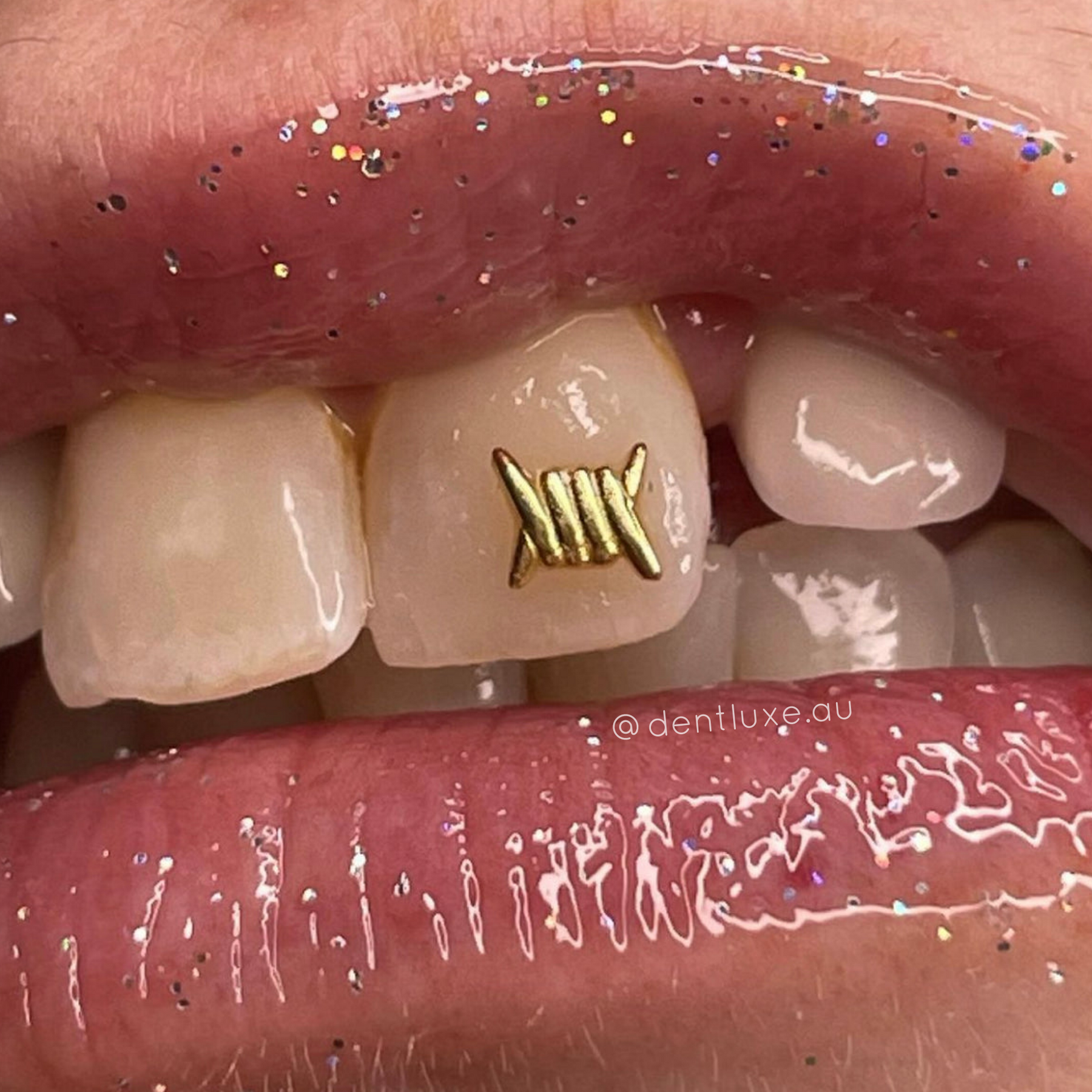 18k Gold Tooth Gem BARBED WIRE Dentluxe - Main Image