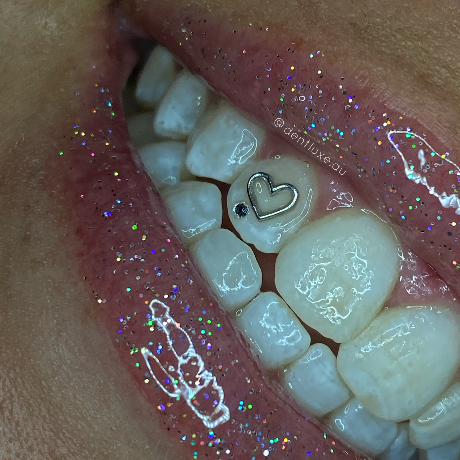 18k Gold Tooth Gems HOLLOW HEART Dentluxe