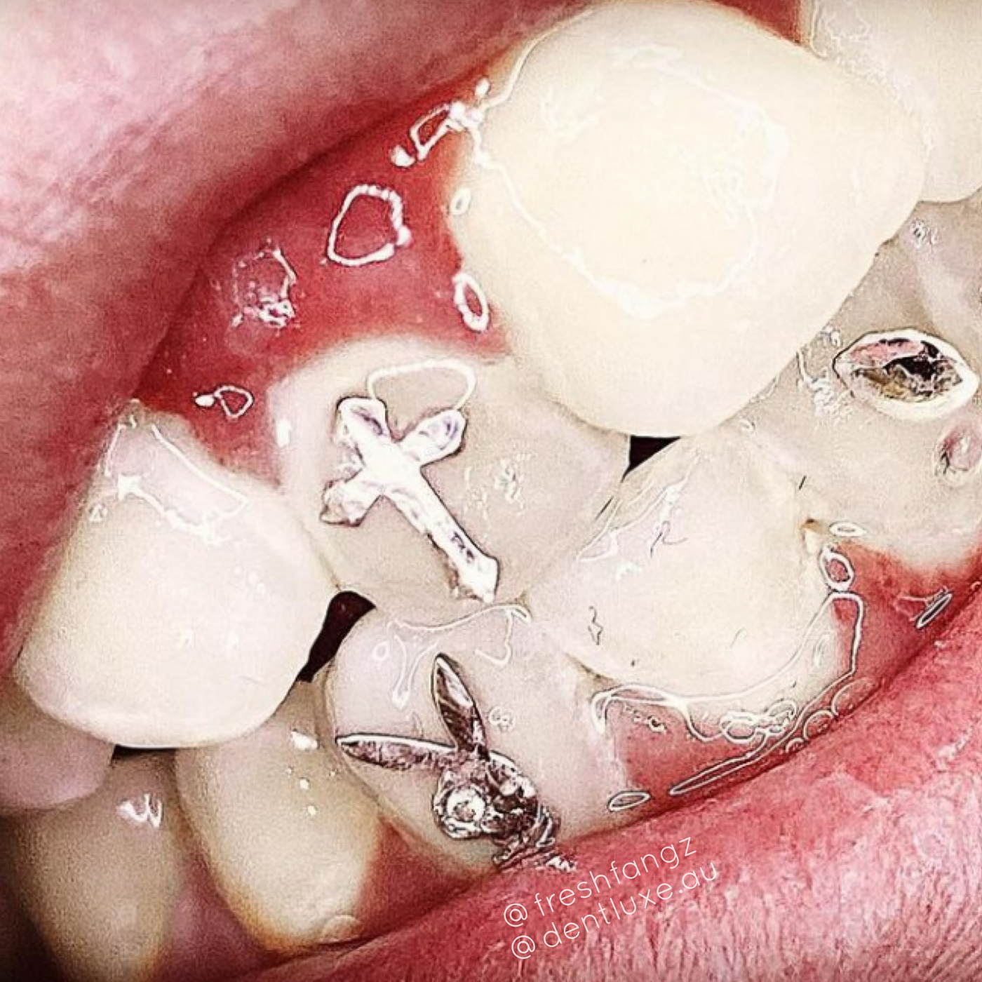 Bunny tooth gem deals