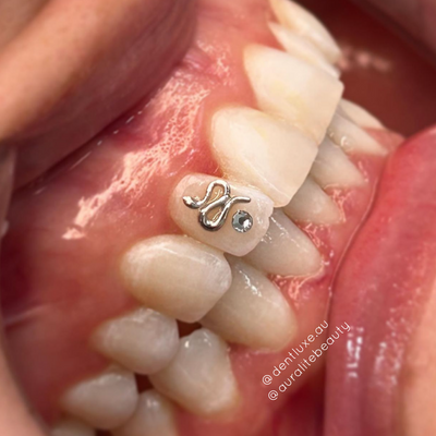 18k Gold Tooth Gem SNAKE Dentluxe