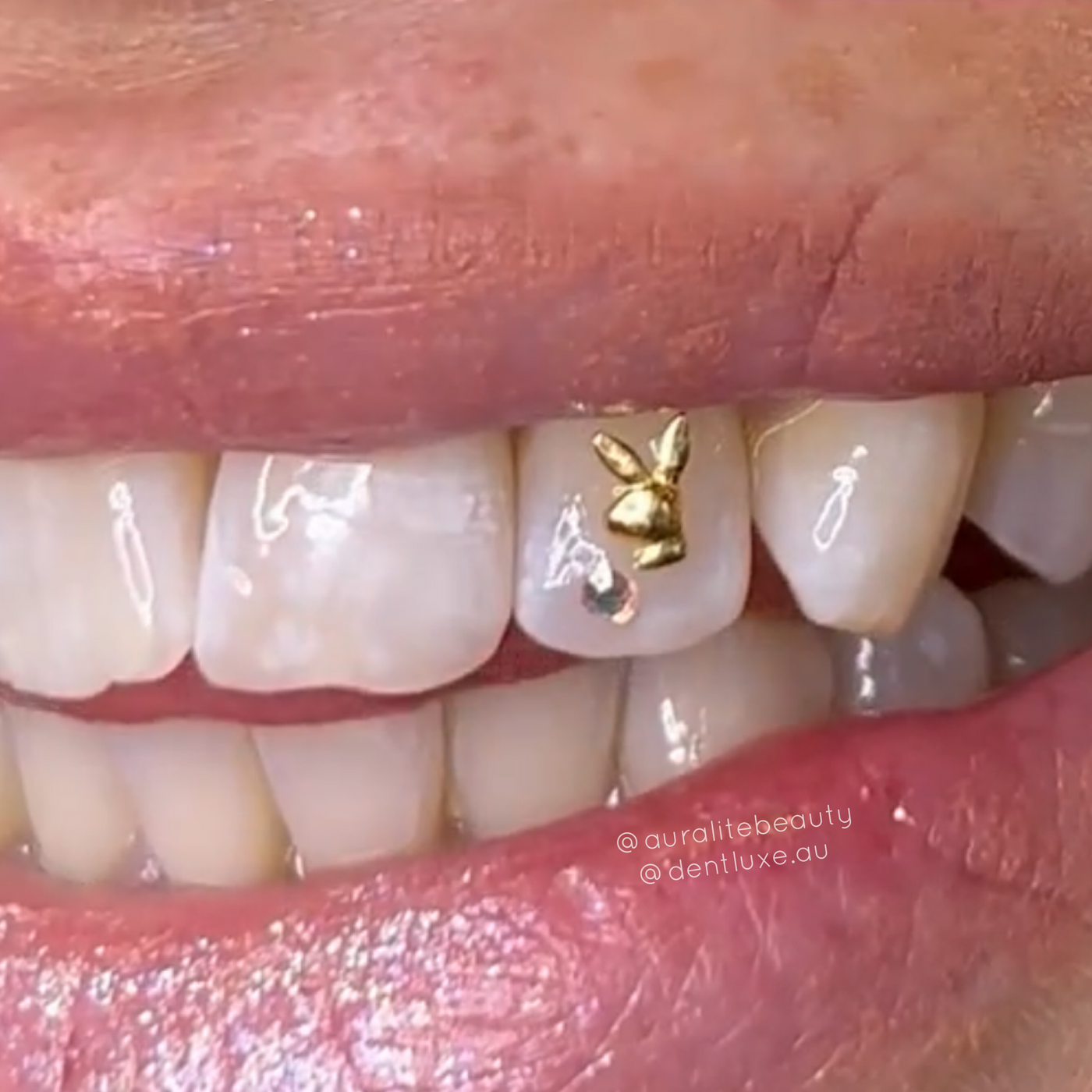 18k Gold Tooth Gem PLAYBOY BUNNY LOGO