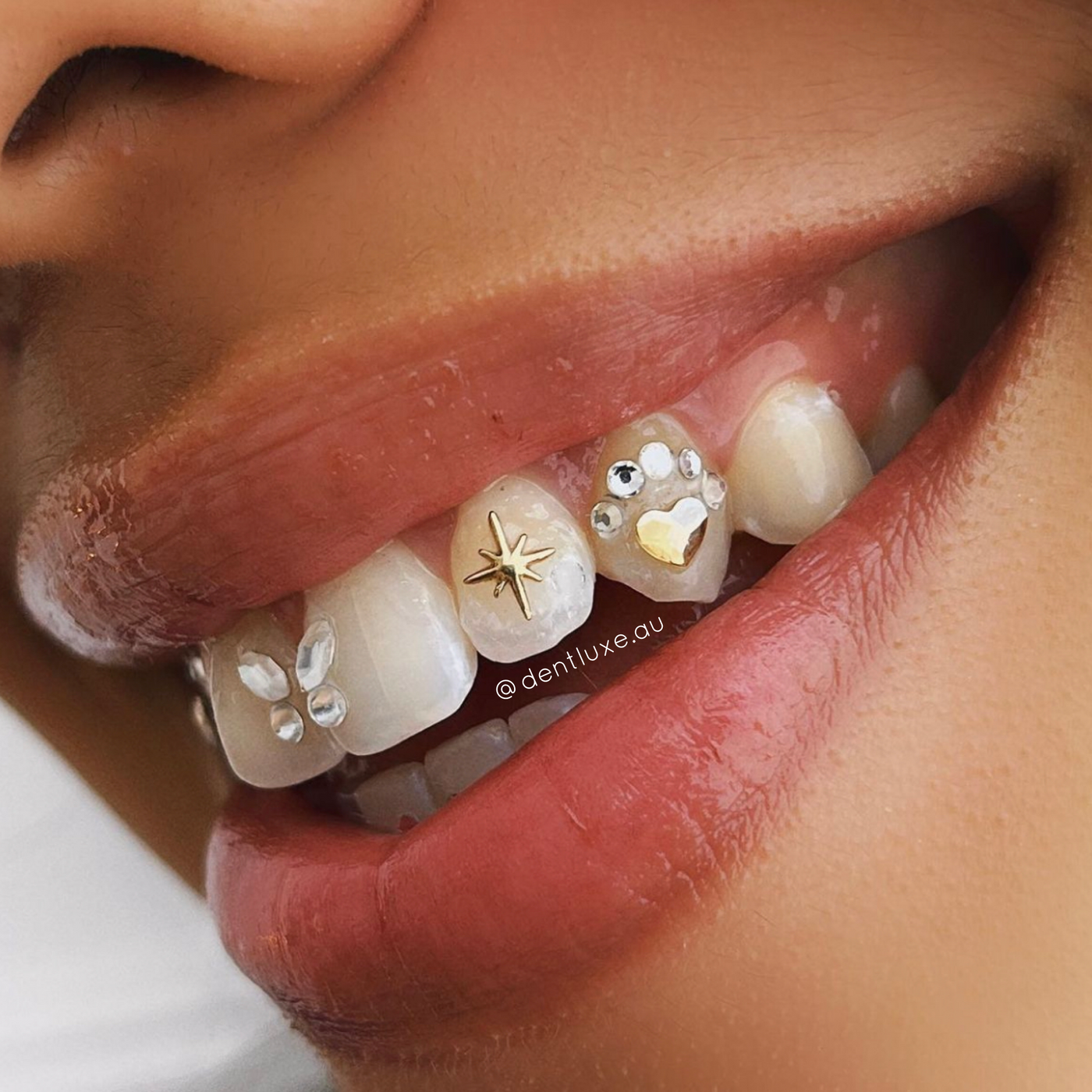 Gold star 2025 tooth gem