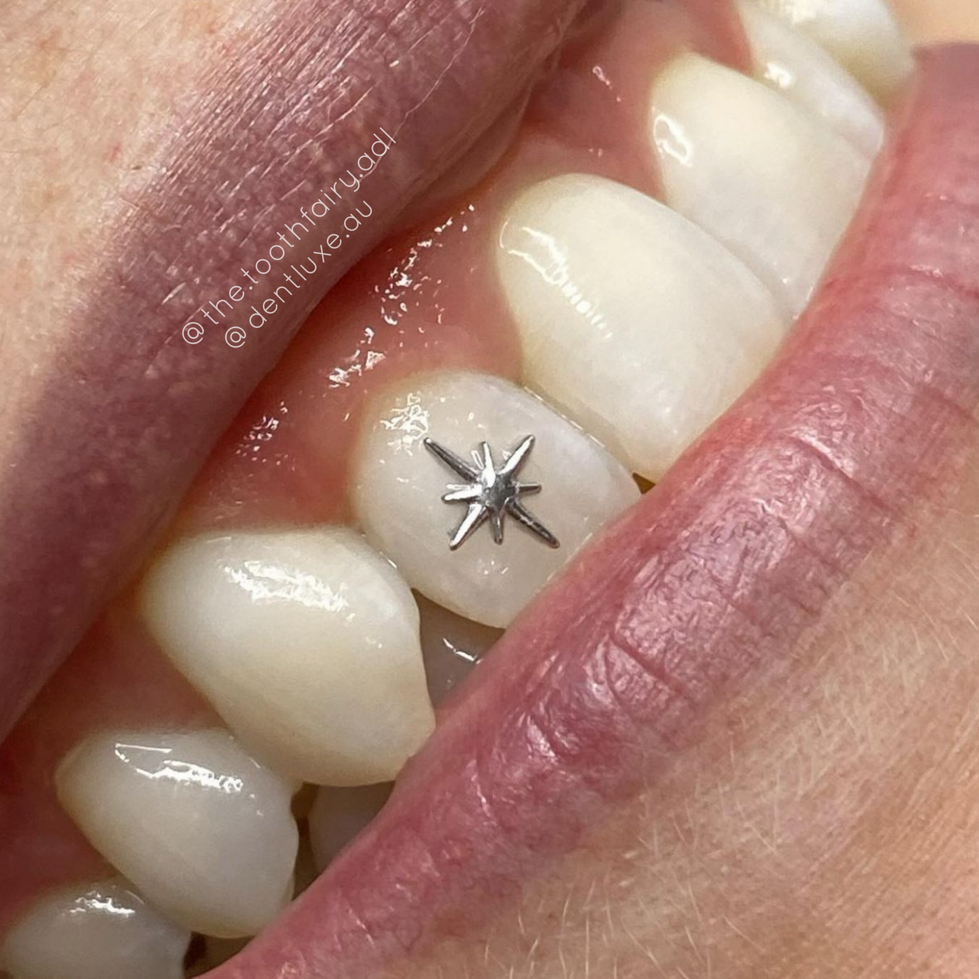 18k STAR SPARK Gold Tooth Gem 