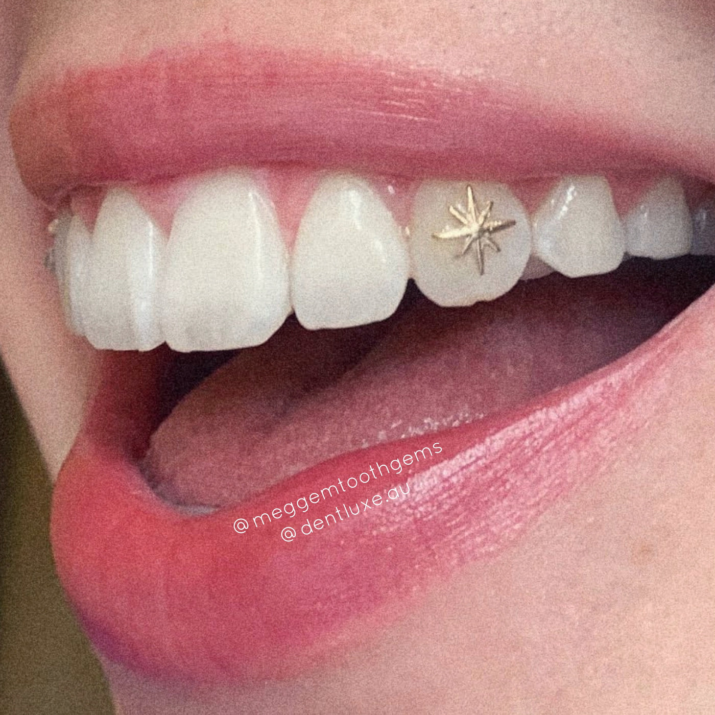 Gold Tooth Gold Tooth