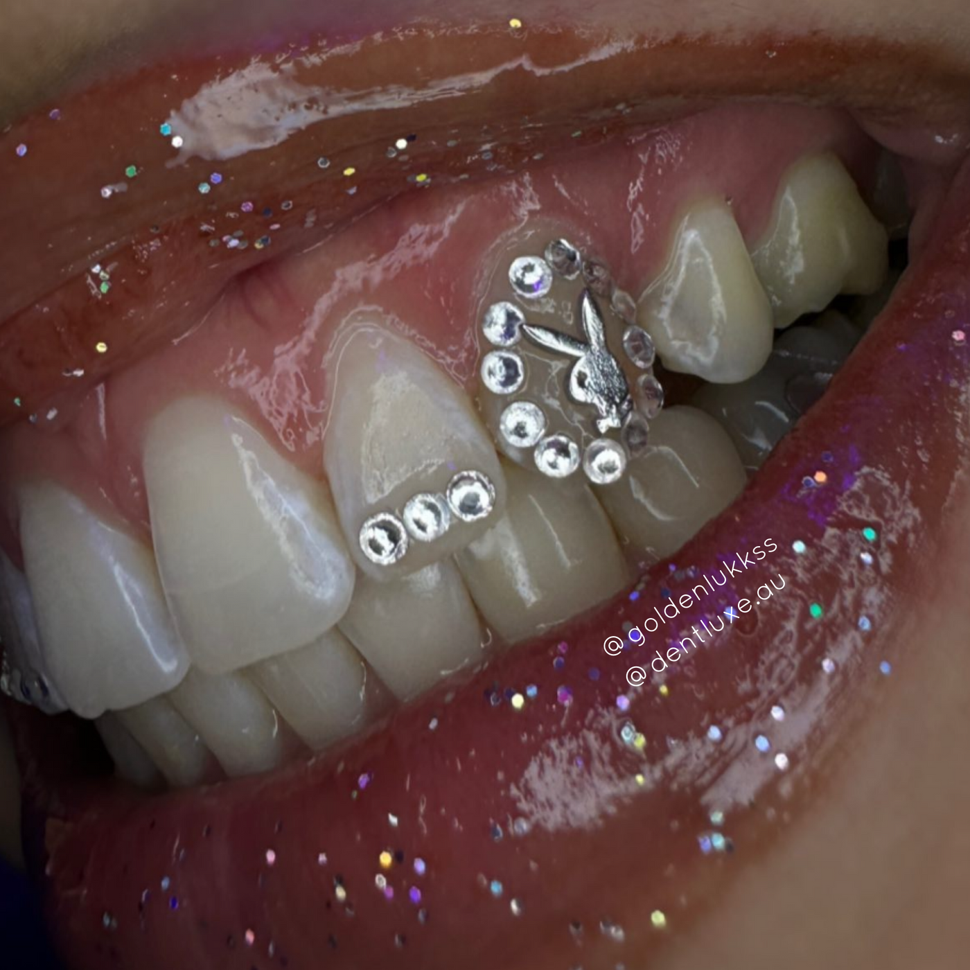 18k Gold Tooth Gems PLAYBOY LOGO Playboy Tooth Gems Dentluxe