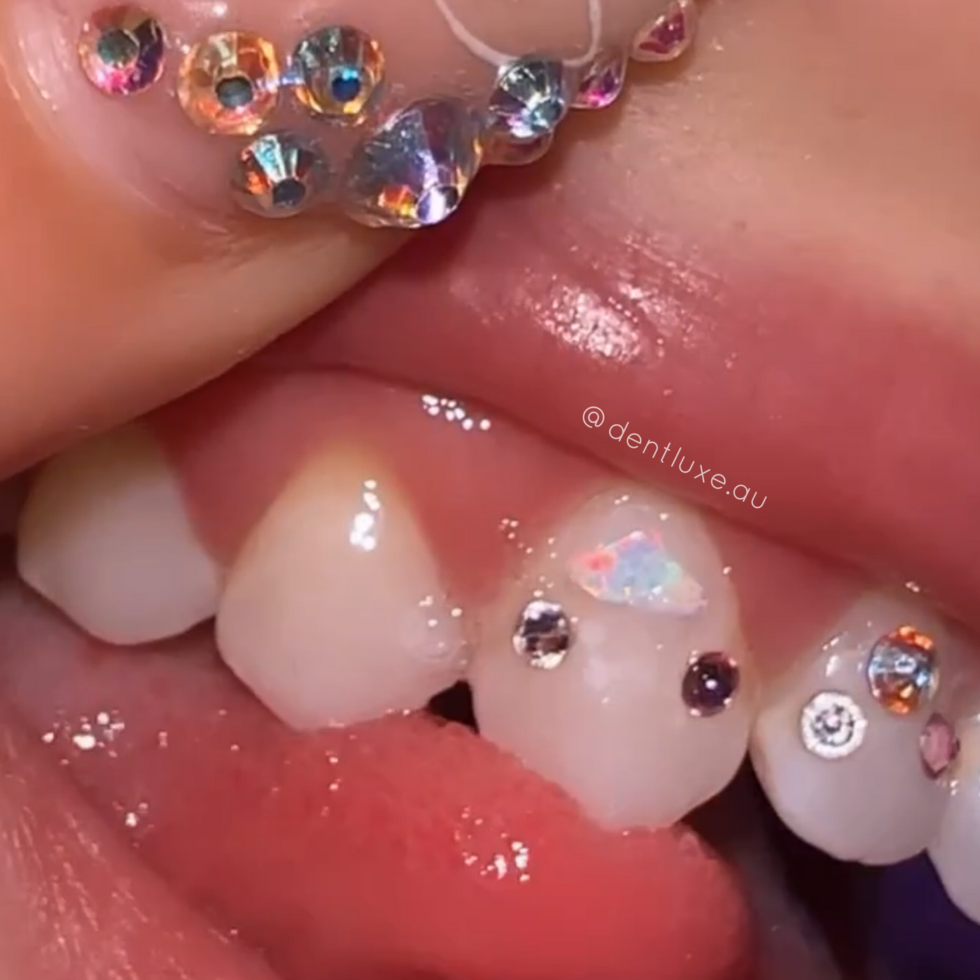 Cloud Opal Tooth Gems