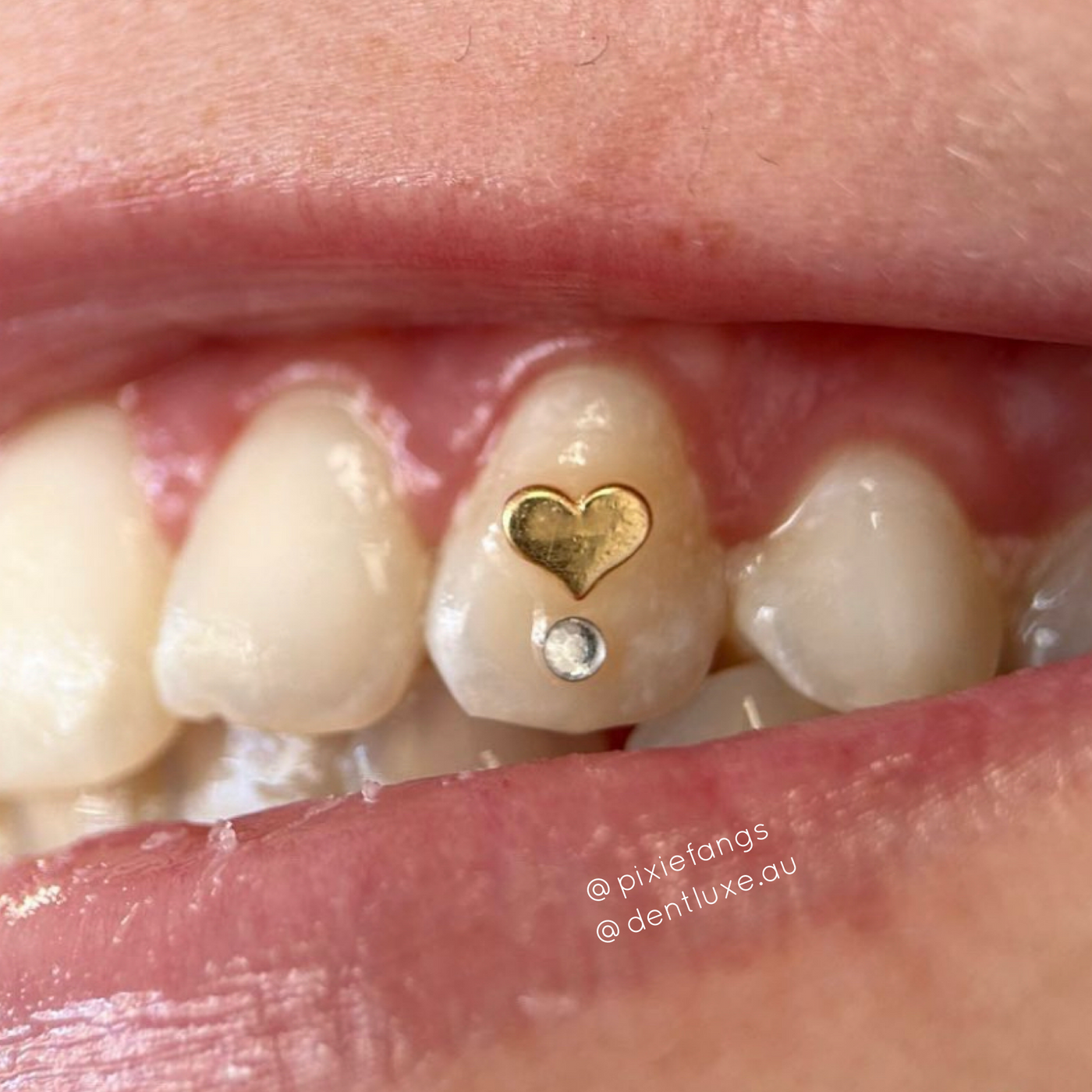 18k Gold Tooth Gem HEART