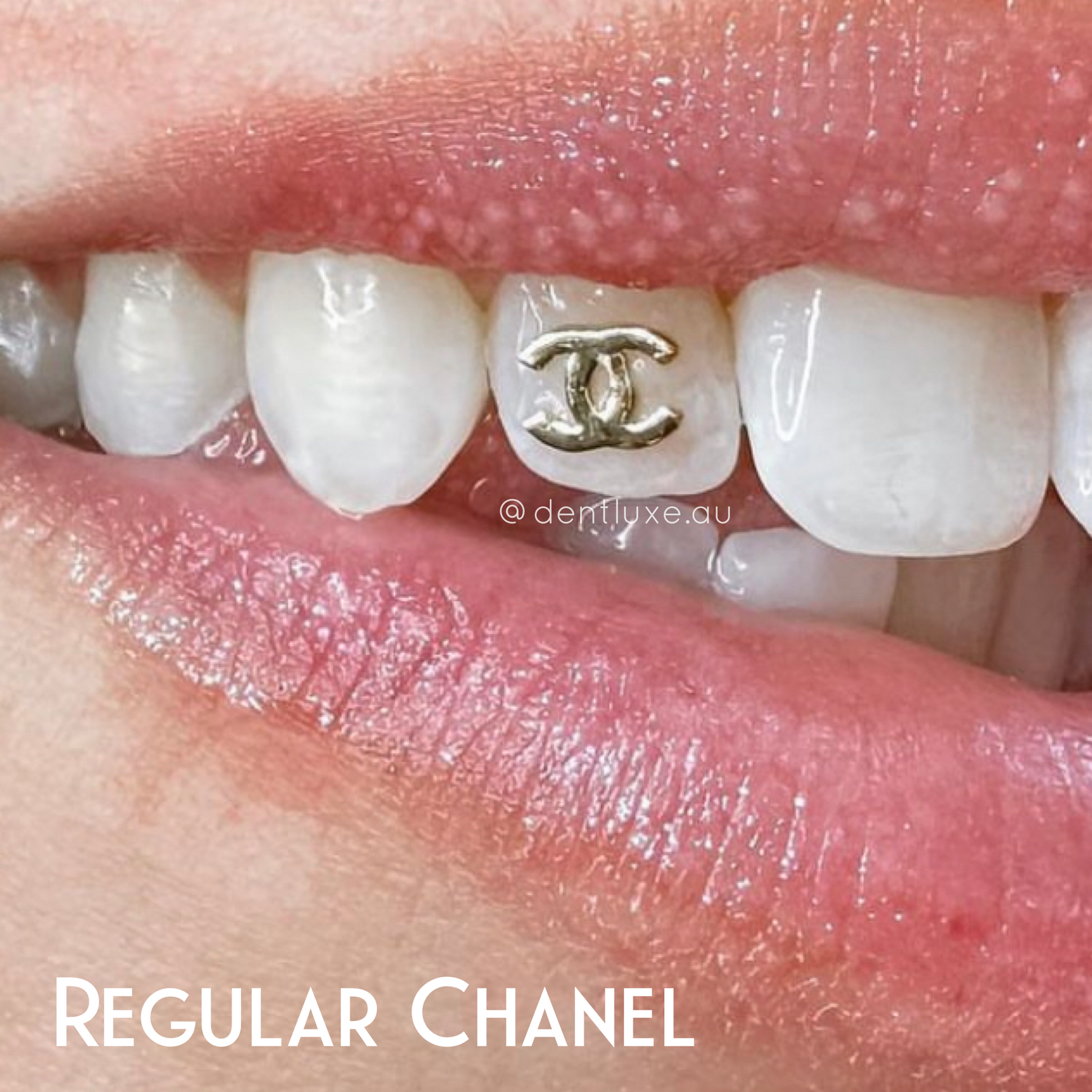 18k Gold Tooth Gems CHANEL Dentluxe