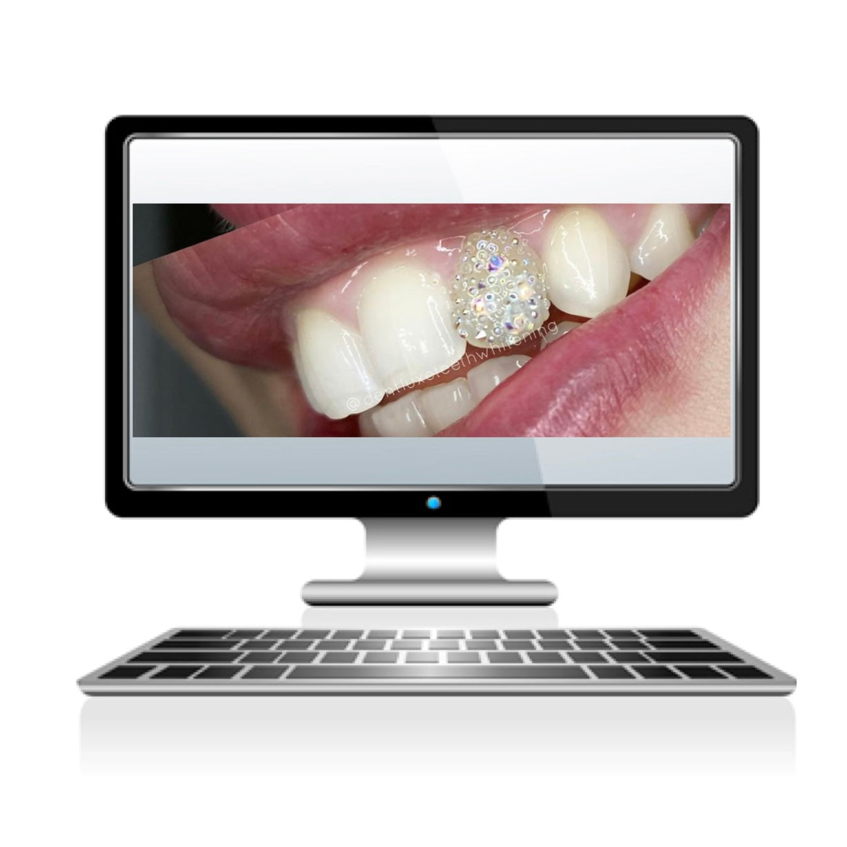 Tooth Gem Online Training Dentluxe