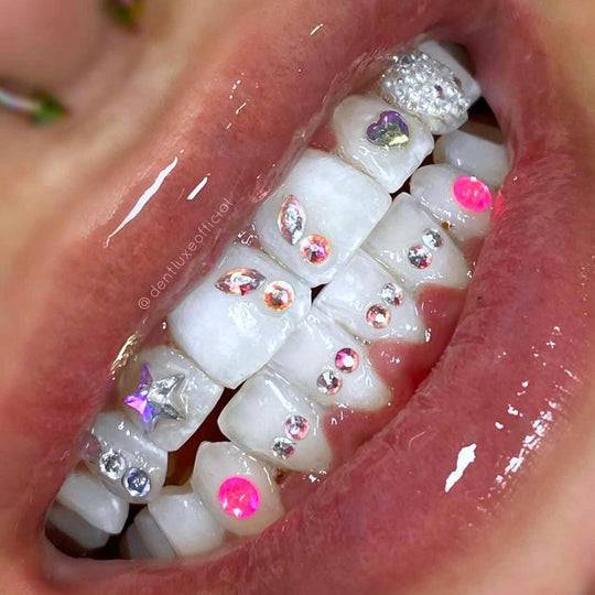 Swarovski Crystals Wings Tooth Gems Dentluxe