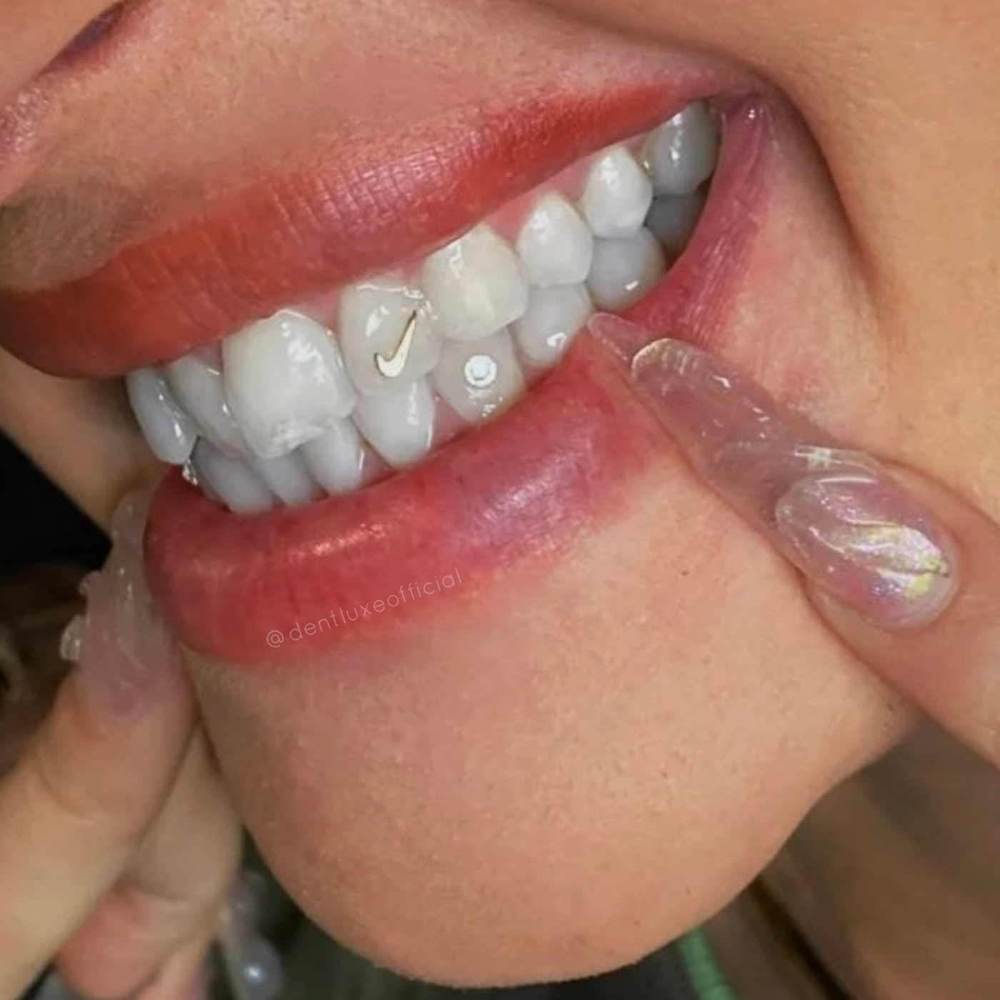 18k Gold Tooth Gems NIKE Dentluxe