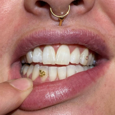 18k OM Gold Tooth Gem