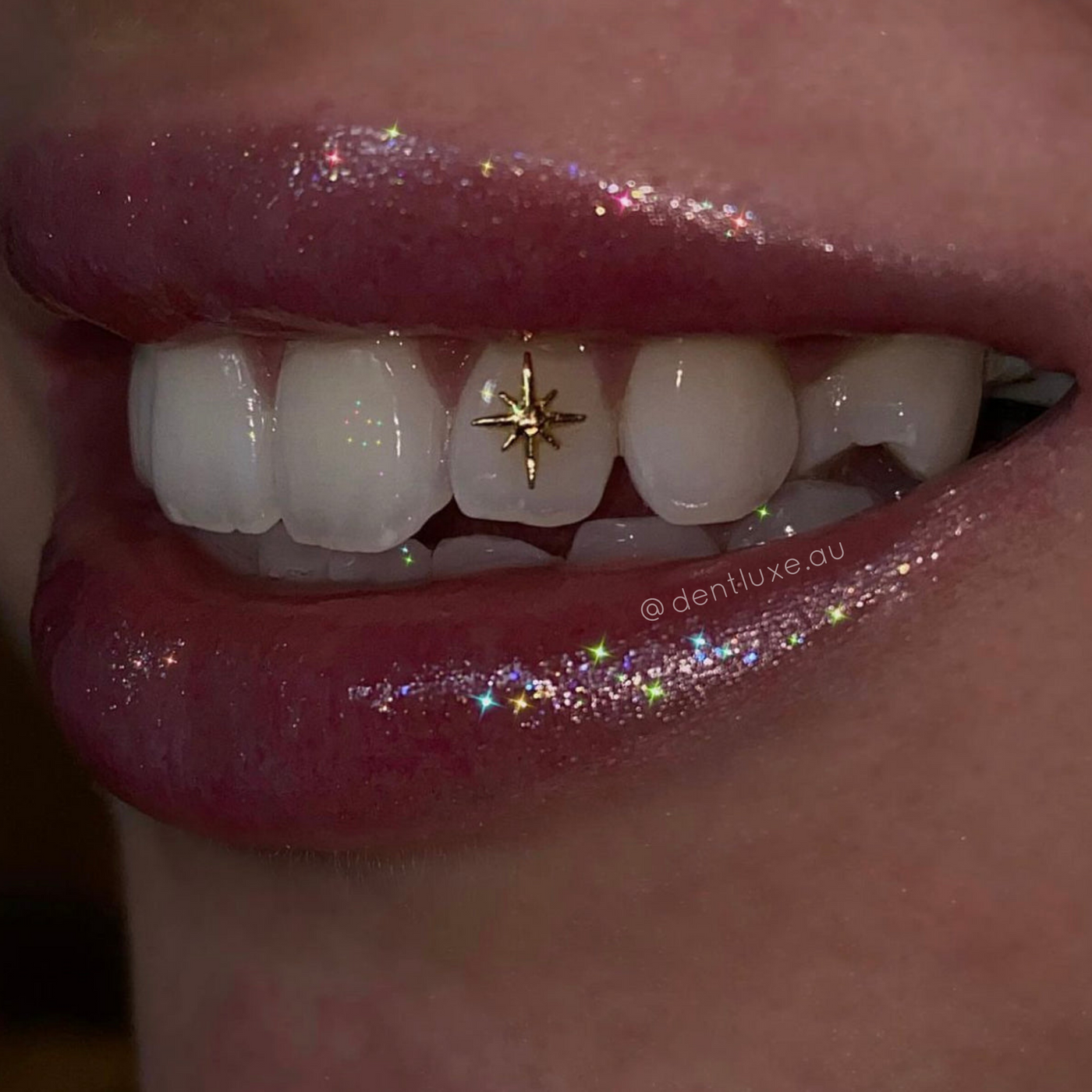 18k STAR SPARK Gold Tooth Gem 