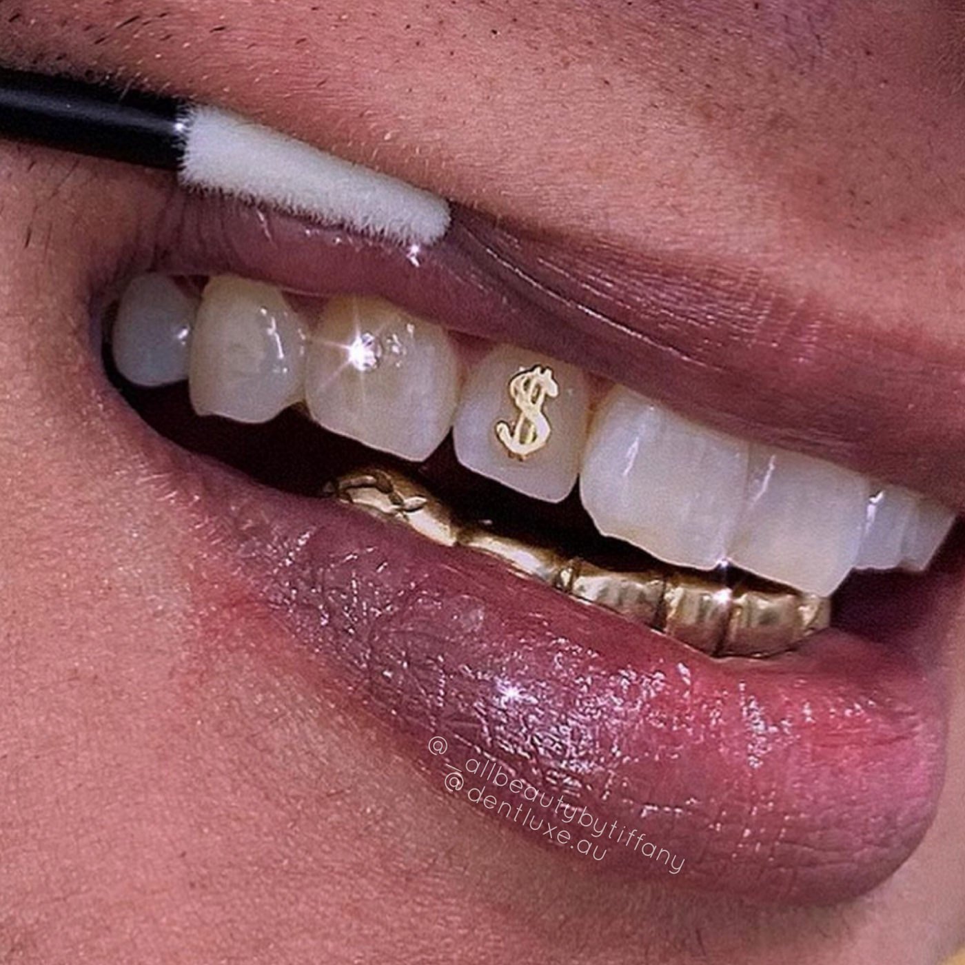 Dollar sign 2025 tooth gem