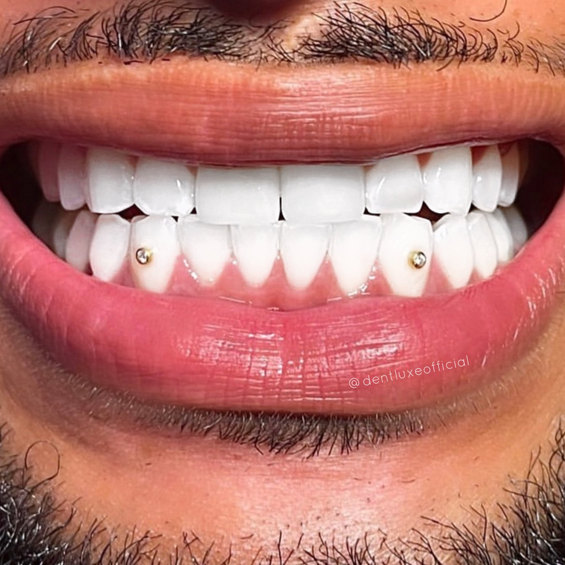 Tooth Bezel Setting Tooth Diamond Bezel 0.006ct VVS - Dentluxe