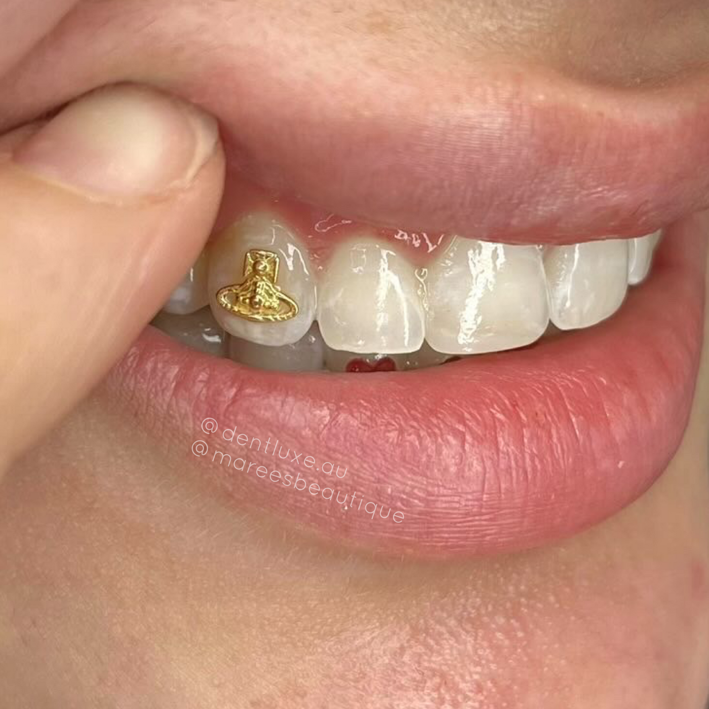 18k Gold Tooth Gem VIVIENNE WESTWOOD LOGO