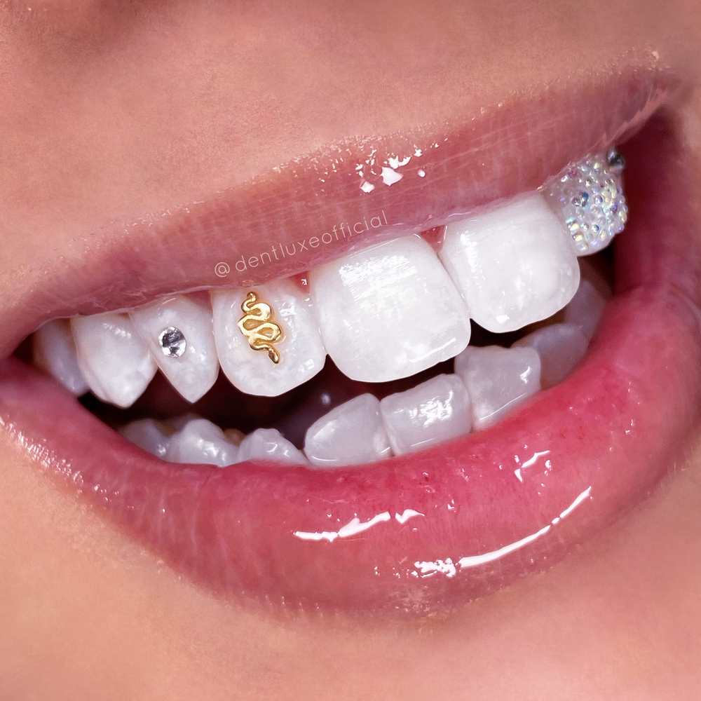 18K GOLD TOOTH GEMS Solid Gold Dentluxe