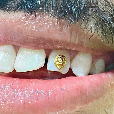 18k MEDUSA LION Gold Tooth Gem 