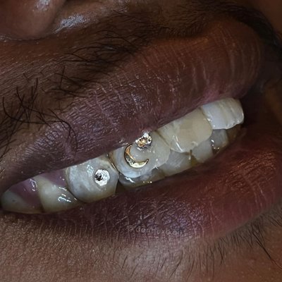 18k Gold Tooth Gem CRESCENT MOON